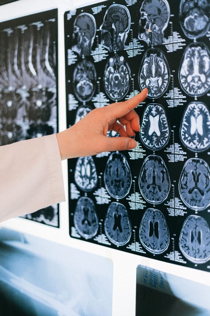 Tests that detect Alzheimer's before symptoms appear post 7